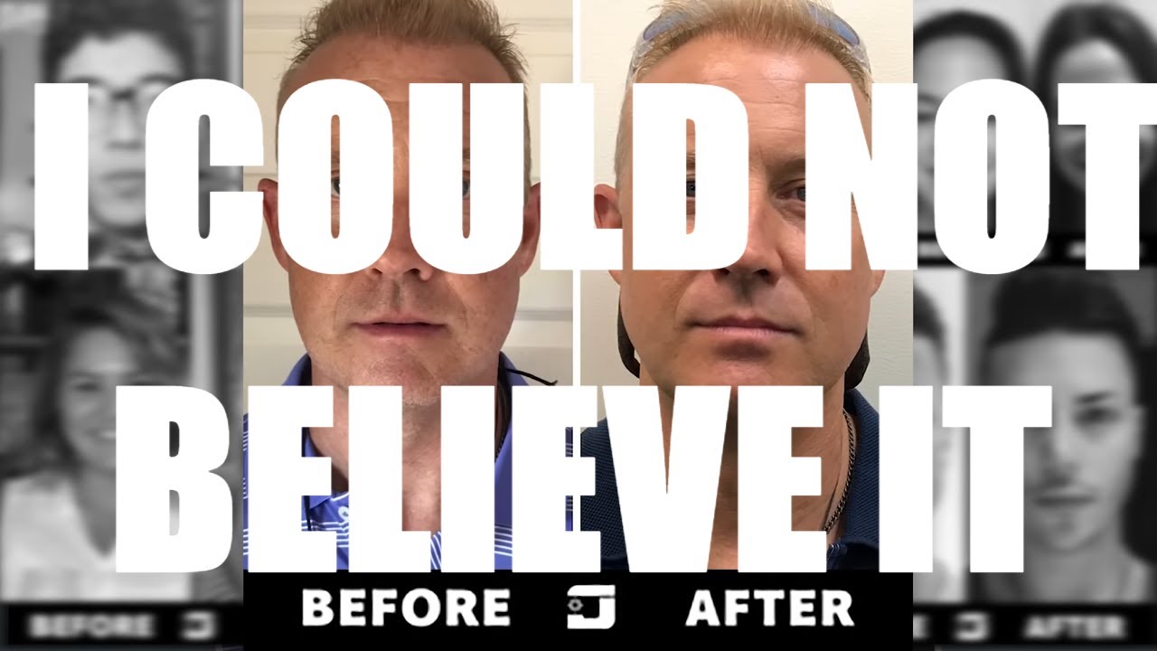 Jawzrsize Review - How To Look Younger
